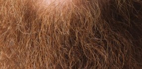 Beard